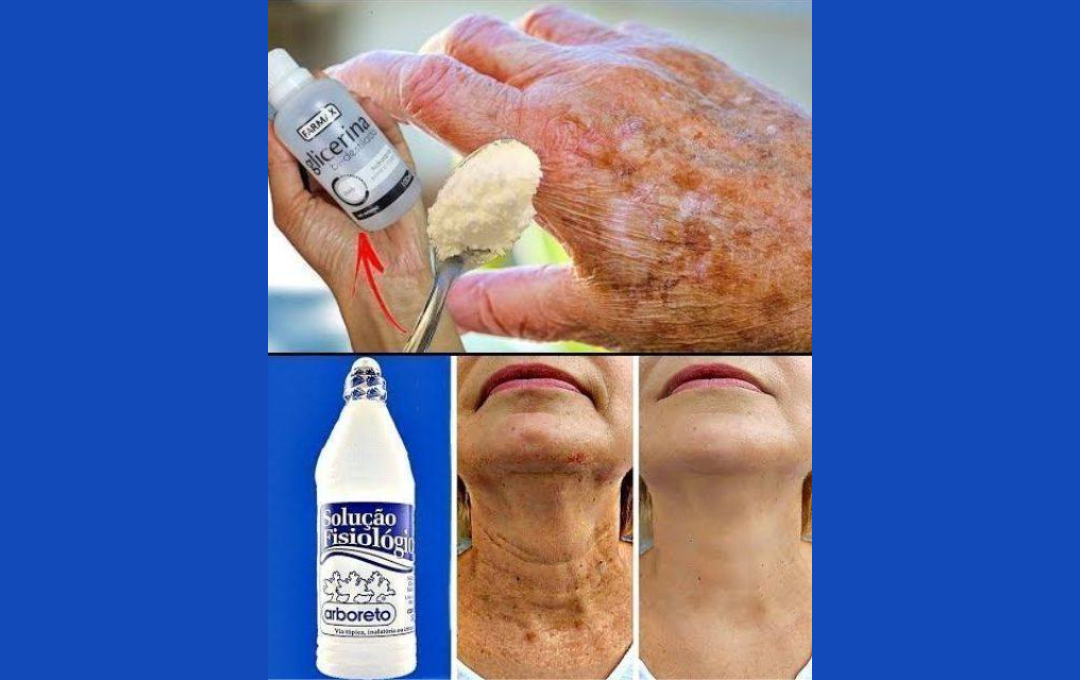 Como Melhorar Manchas E Linhas De Expressão Com Um Esta Máscara Natural Renovadora